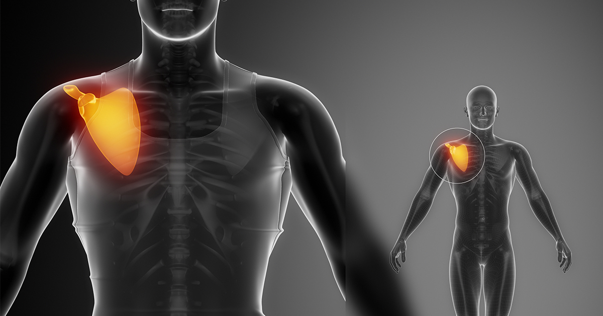 3 Common AC Joint Injuries