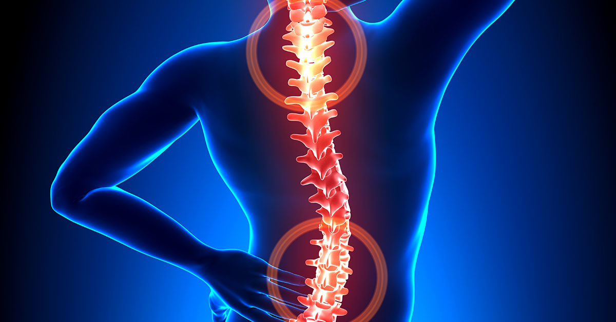 Anterior Cervical Discectomy with Fusion