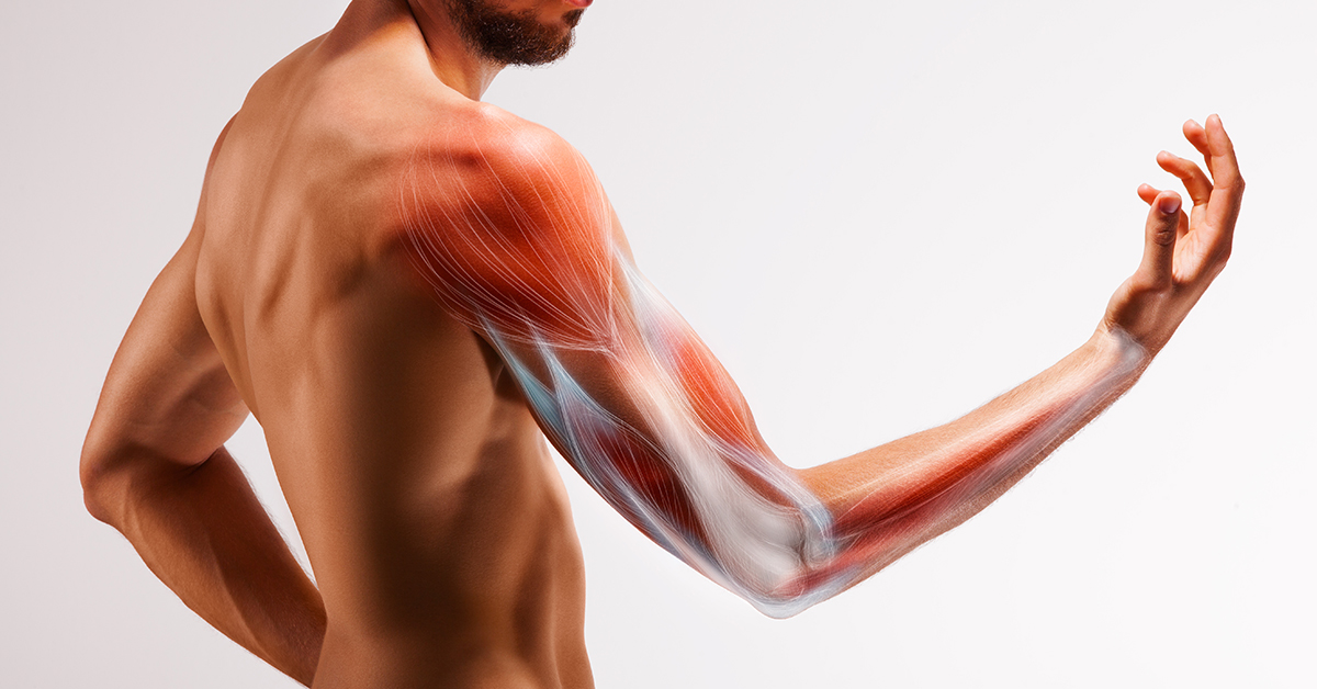 Biceps Tendon Rupture Treatment