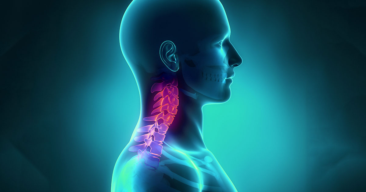 Fractures Of The Neck Atlanta GA Spine Surgery