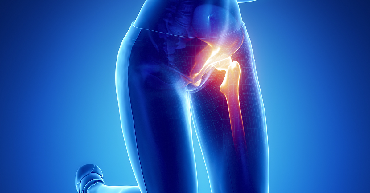 Hip Treatments