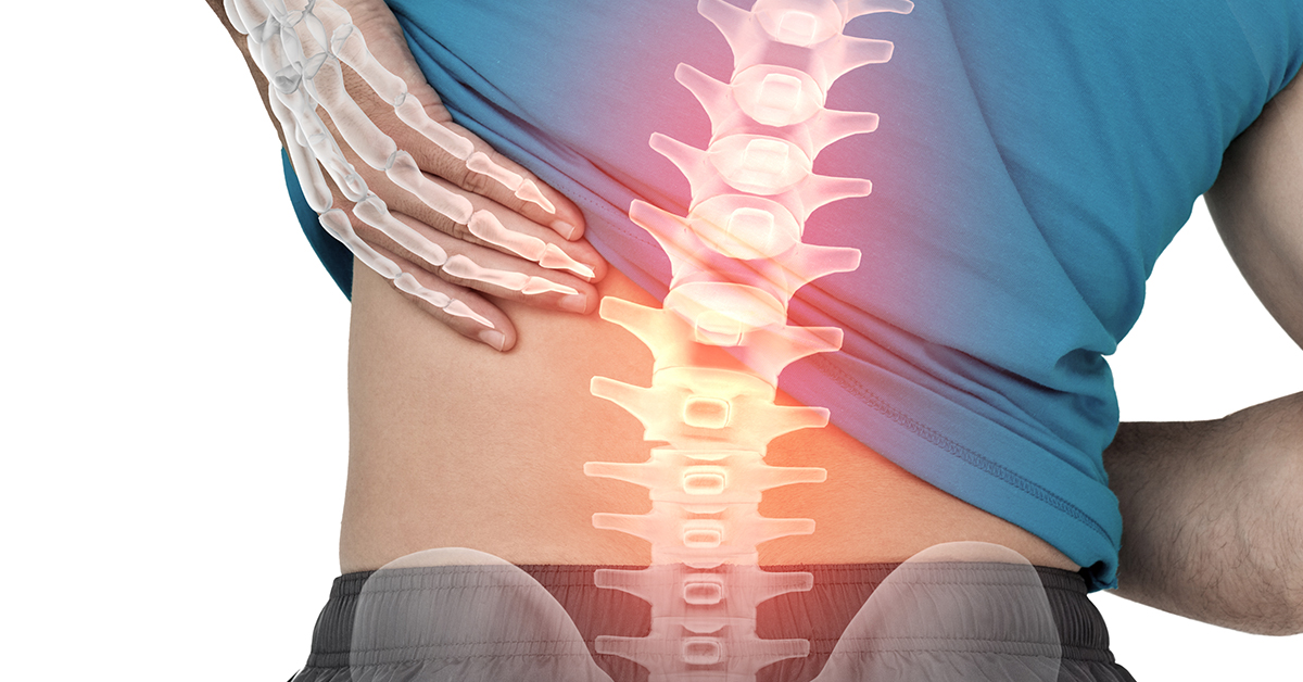 How to Destroy Your Spine: Part 1
