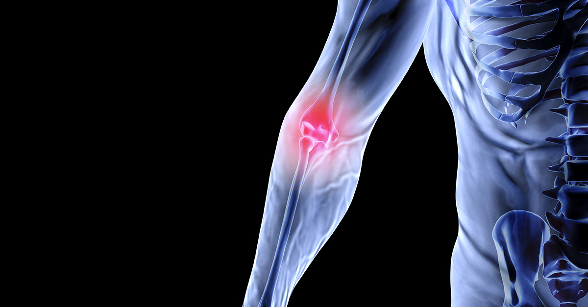 Hyperextension Injury of the Elbow