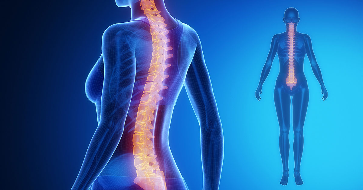 Upper Back Pain  Scottsdale, AZ Orthopedic Spine Surgery