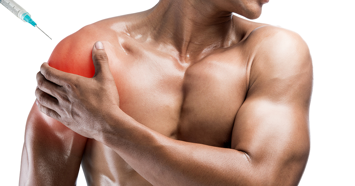 Ultrasound-guided Injections for Shoulder Pain