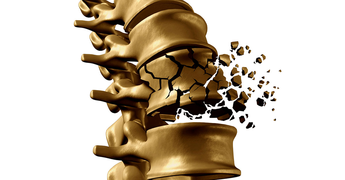 vertebral compression fracture treatment in elderly