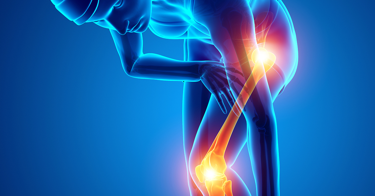 Why Joint Replacements Do Not Last Forever