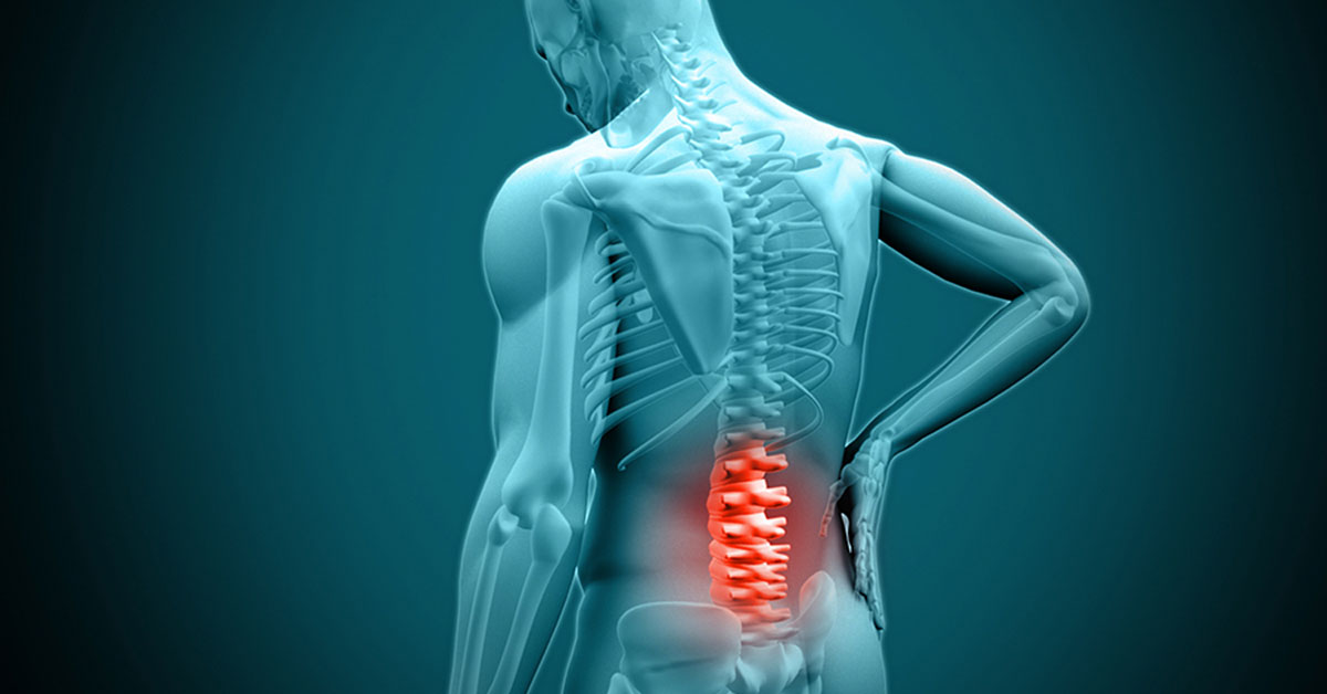 Nashville, TN - Lumbar Decompression - Dube Orthopedics